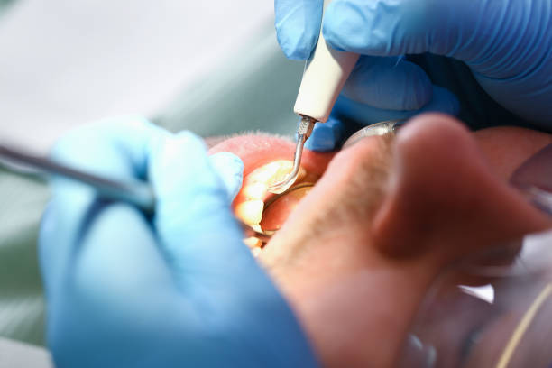 Best Pediatric Emergency Dentist in Ferry Pass, FL