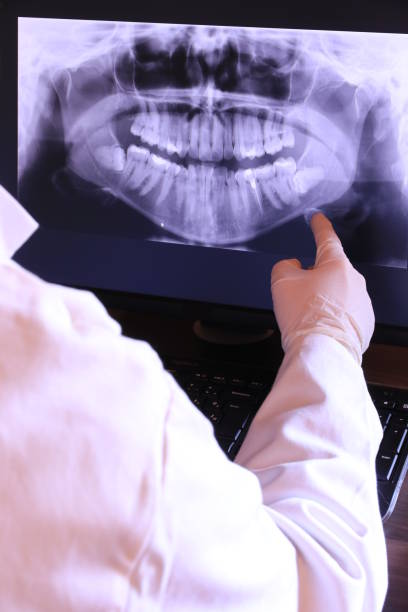 Best Emergency Wisdom Teeth Removal in Ferry Pass, FL